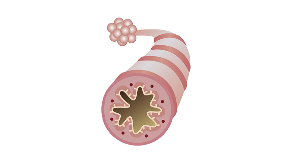 asthmatic-lung-airway-image